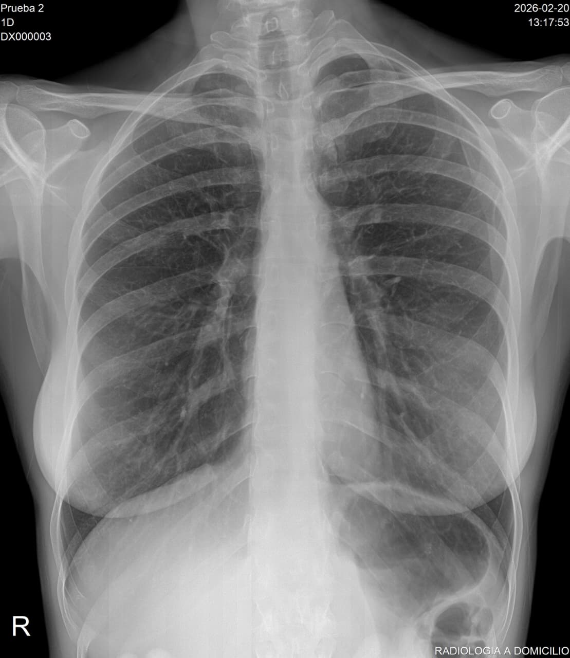 LIC. BELLETTI MIGUEL - SERVICIO DE RADIOLOGIA MOVIL — foto 4 de 4